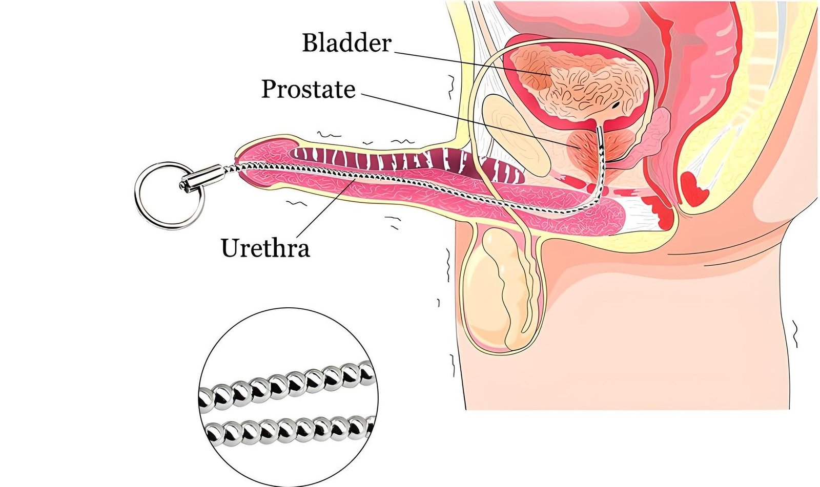 diagram of penis sounding